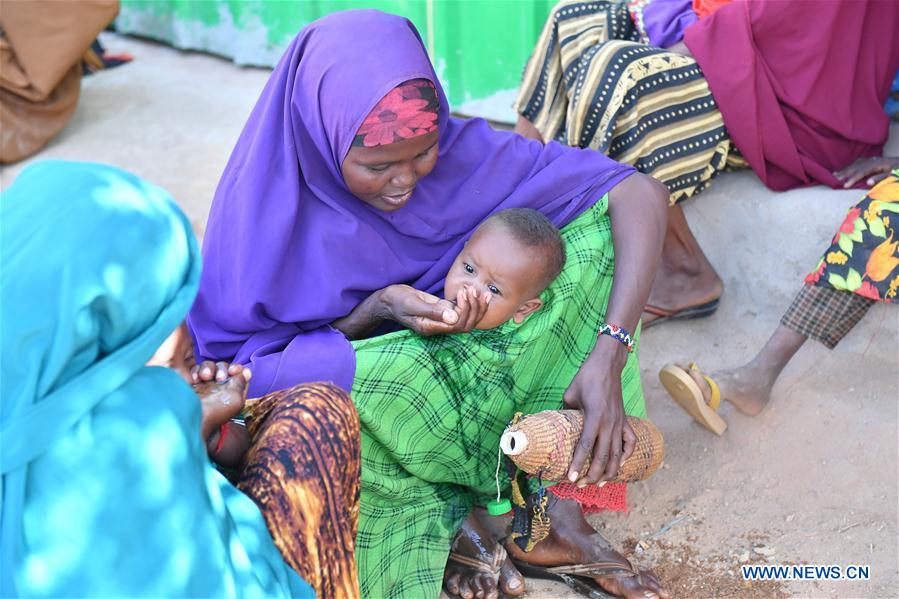SOMALIA-DOOLOW-CHILDREN-MALNUTRITION