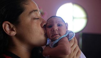 Brazil confirms 1,581 cases of microcephaly related to Zika so far