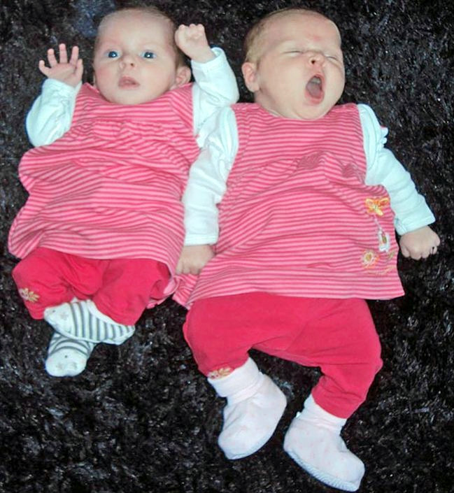 英国出生一对罕见双胞胎体重相差1.2公斤 2011年7月，英国孕妇帕梅拉产下了一对双胞胎女儿，两个宝宝出生时体重竟相差1.2公斤，极为罕见。帕梅拉称，当她得知自己怀了双胞胎时曾感到困惑，怕自己一开始分不清两个宝宝。但是孩子出生后，帕梅拉的疑虑全都消失了。因为这对双胞胎姐妹中，姐姐波比的体重是2.5公斤，而妹妹黛西则有3.7公斤重，身子比姐姐看起来整整大了一圈，腿长了不少。姐妹俩因此让人一眼就能区分开。