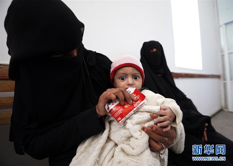 （外代一线）（4）也门：将近220万儿童营养不良