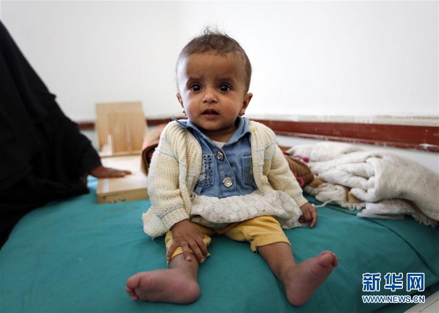 （外代一线）（5）也门：将近220万儿童营养不良