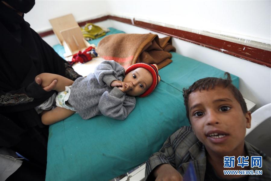 （外代一线）（6）也门：将近220万儿童营养不良