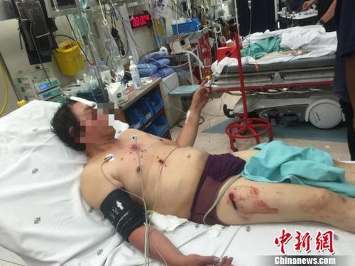 图为来自广西柳州的受伤男子。钟欣 摄
