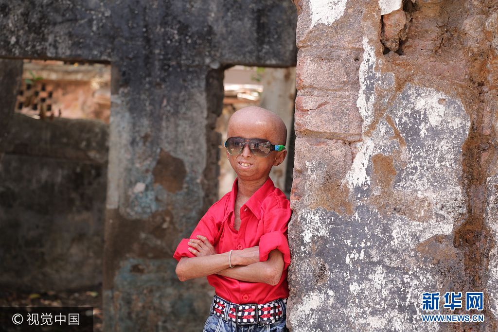 2017年9月11日（具体拍摄时间不详），印度中央邦，来自印度中央邦的11岁男孩Shreyash Barmate外表看起来就像是个老人，这是因为他患有早衰症，衰老速度是同龄人的8倍。虽然只有11岁，Shreyash已经长了皱纹，并且还出现了秃发，四肢也比同龄人要脆弱。尽管很有可能在2年后死去，Shreyash并没有放弃对未来的希望，他唱歌，弹奏乐器，骑自行车，开汽车，也会去游泳。他说自己长大后想成为一名歌手。***_****** EXCLUSIVE ***                                                  MADHYA PRADESH, INDIA - SEPTEMBER 2017: Shreyash Barmate, 11, who suffers from Progeria, poses for a picture on September, 2017 in Madhya Pradesh, India.                                                  An inspirational boy with an ultra-rare genetic condition that makes him look like an old man refuses to let it hold him back ? and even drives a car. Shreyash Barmate, 11 who lives in Madhya Pradesh, India, has progeria ? a condition which causes rapid aging in children. The condition leaves Shreyash suffering from baldness, heavy wrinkles and weakened limbs. The Progeria Research Foundation believe the syndrome is so rare it affects around 1 in 20 million people.                                                   PHOTOGRAPH BY Rare Shot / Barcroft Images                                                  London-T:+44 207 033 1031 E:hello@barcroftmedia.com - New York-T:+1 212 796 2458 E:hello@barcroftusa.com - New Delhi-T:+91 11 4053 2429 E:hello@barcroftindia.com www.barcroftimages.com                         PHOTOGRAPH BY Rare Shot / Barcroft Images