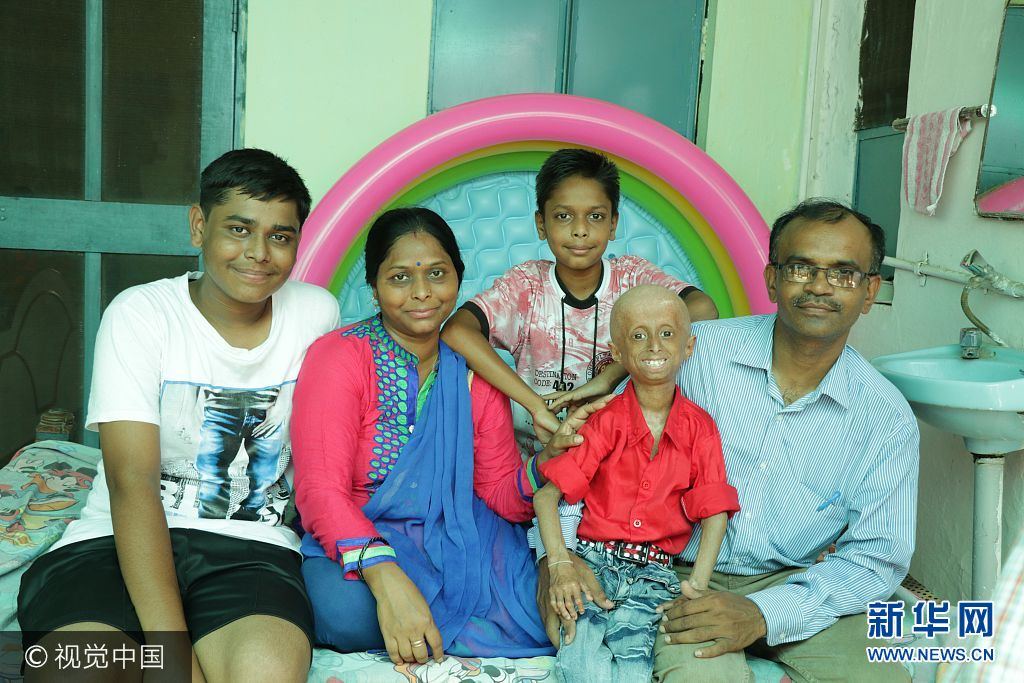 2017年9月11日（具体拍摄时间不详），印度中央邦，来自印度中央邦的11岁男孩Shreyash Barmate外表看起来就像是个老人，这是因为他患有早衰症，衰老速度是同龄人的8倍。虽然只有11岁，Shreyash已经长了皱纹，并且还出现了秃发，四肢也比同龄人要脆弱。尽管很有可能在2年后死去，Shreyash并没有放弃对未来的希望，他唱歌，弹奏乐器，骑自行车，开汽车，也会去游泳。他说自己长大后想成为一名歌手。***_****** EXCLUSIVE ***                                                  MADHYA PRADESH, INDIA - SEPTEMBER 2017: Shreyash Barmate, 11, who suffers from Progeria, poses for a picture with his family on September, 2017 in Madhya Pradesh, India.                                                  An inspirational boy with an ultra-rare genetic condition that makes him look like an old man refuses to let it hold him back ? and even drives a car. Shreyash Barmate, 11 who lives in Madhya Pradesh, India, has progeria ? a condition which causes rapid aging in children. The condition leaves Shreyash suffering from baldness, heavy wrinkles and weakened limbs. The Progeria Research Foundation believe the syndrome is so rare it affects around 1 in 20 million people.                                                   PHOTOGRAPH BY Rare Shot / Barcroft Images                                                  London-T:+44 207 033 1031 E:hello@barcroftmedia.com - New York-T:+1 212 796 2458 E:hello@barcroftusa.com - New Delhi-T:+91 11 4053 2429 E:hello@barcroftindia.com www.barcroftimages.com                         PHOTOGRAPH BY Rare Shot / Barcroft Images