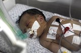 加沙：医生为死去孕妇剖腹产 救出孩子(组图)